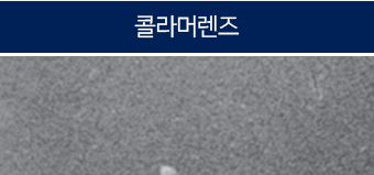 아크릴 렌즈