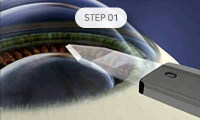 step01
