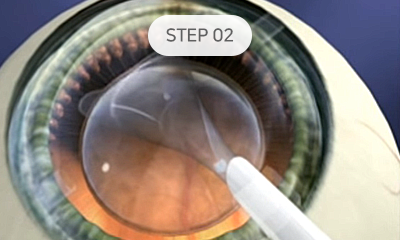 step02