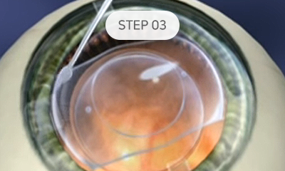 step03